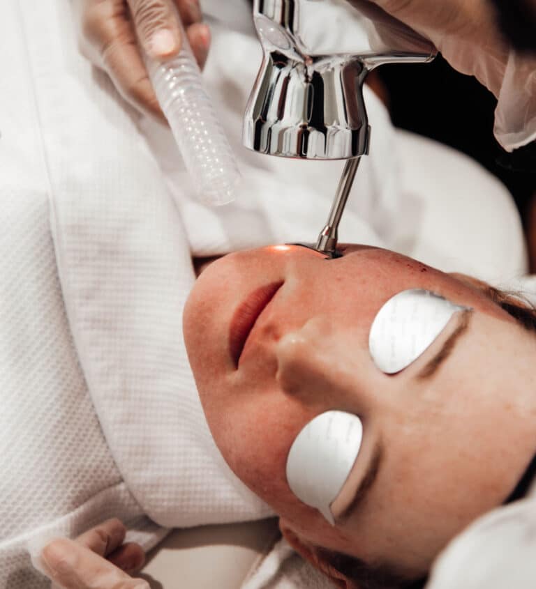 Scar Treatments and Reduction Serving Vancouver & Surrey