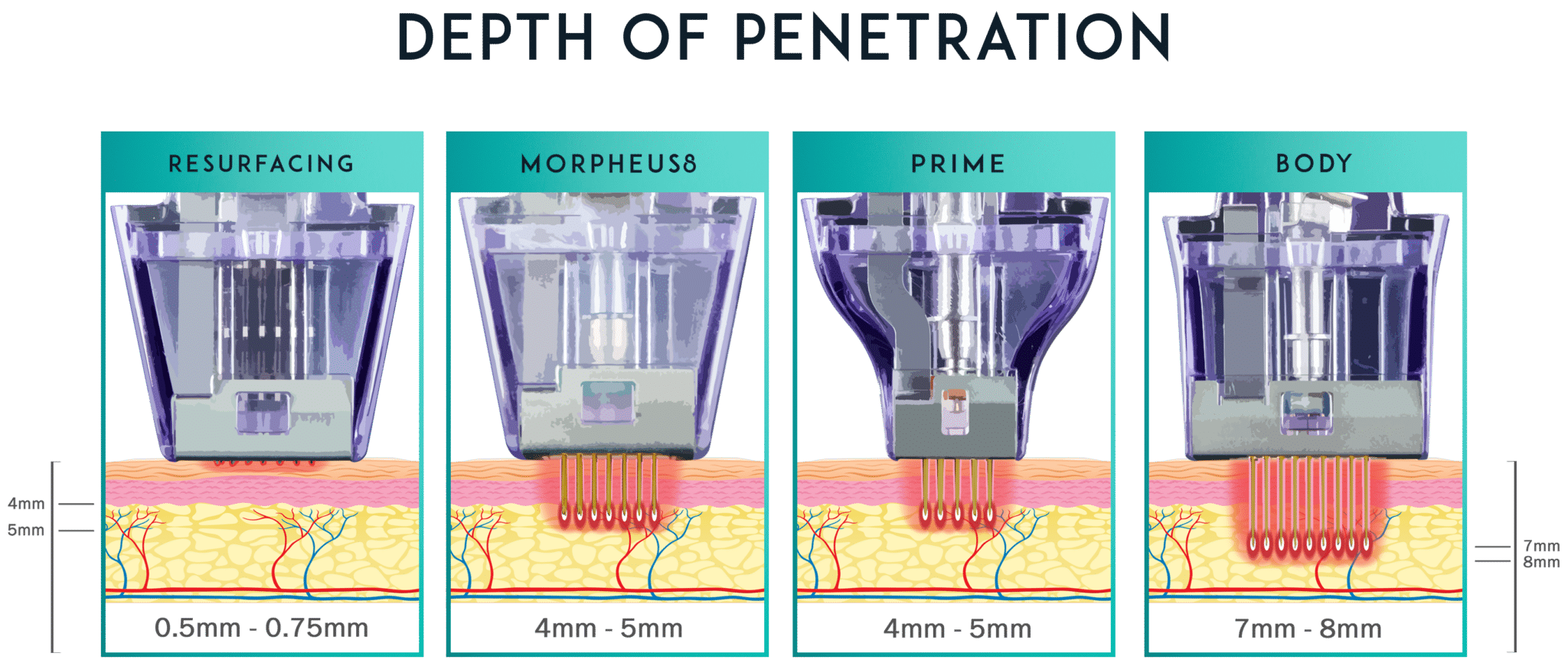 Morpheus8 Vancouver Clinic RF Microneedling Morpheus 8